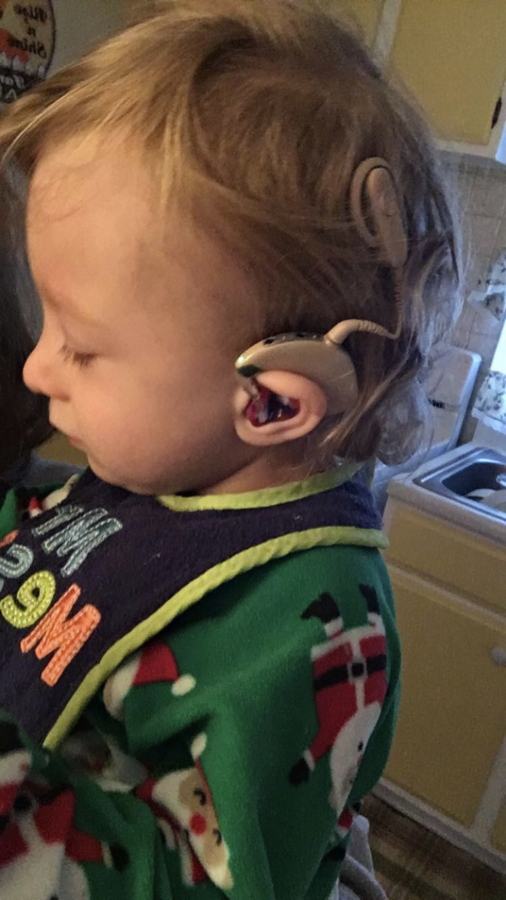 Kayden+is+wearing+his+cochlear+implants+on+the+Christmas+of+2016.+It+can+clearly+be+seen+that+their+is+one+piece+in+which+sticks+onto+the+magnet+that+was+placed+within+his+head+during+surgery+and+another+part+in+which+hooks+onto+his+ear.